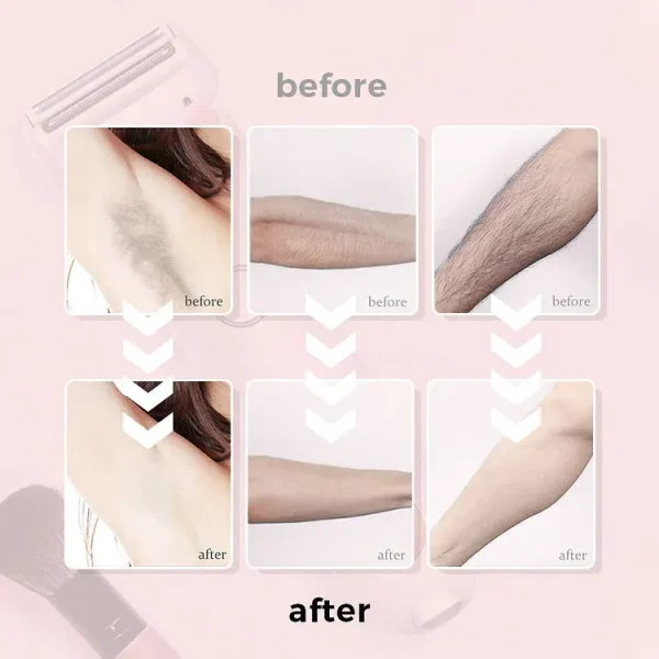 Multi-functional Women's Portable Epilator - Image 9