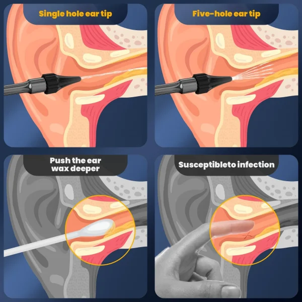 Flush Earwax Remover - Image 12