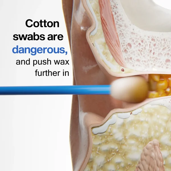 Flush Earwax Remover - Image 7